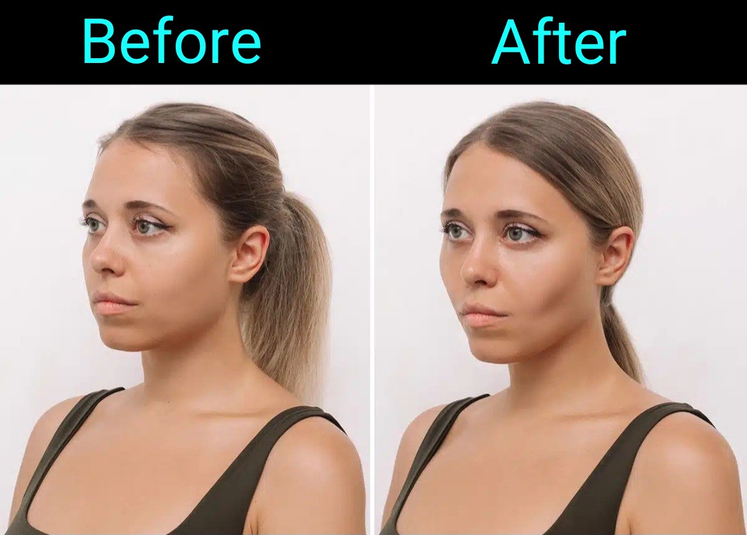 Read more about the article How to loose face fat